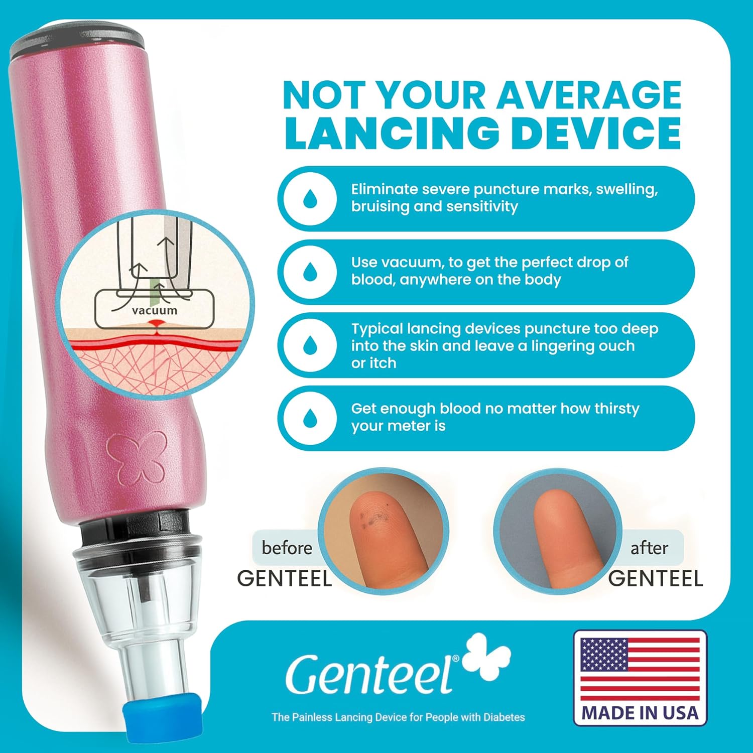 Genteel Plus - No Prick Pain Vacuum Lancing Device for Diabetes Testing - Blood Sugar, Glucose, Ketone, and DNA Home Tests (Playful Purple)