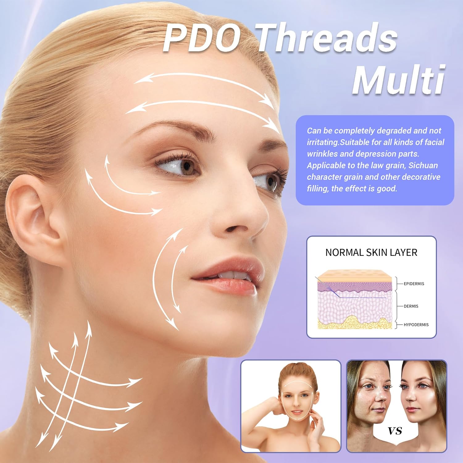 PDO Threads Multi, Face  Whole Body Lift Threads, Blunt L-Type PDO Threads Lift (16PCS-21G-50mm (l))